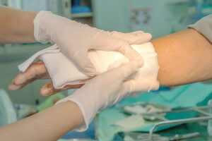 "Healthcare worker bandaging patient’s hand in clinical setting.". Car Accident Burn Injury Lawyer